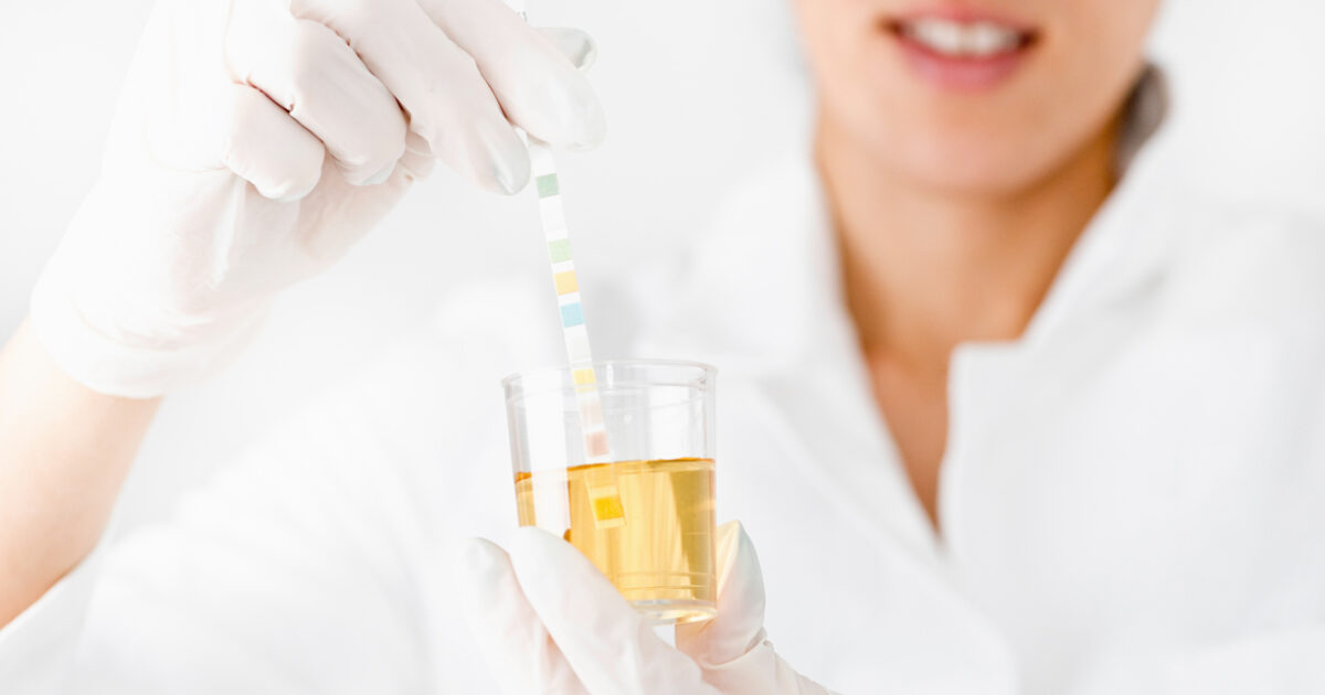 Urine POCT drug testing